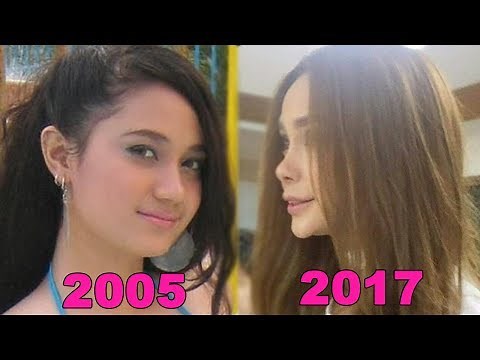 ARCI MUNOZ PLASTIC SURGERIES THROUGH THE YEARS