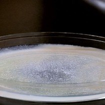 Video: Prostaglandin Extraction and Analysis in Caenorhabditis elegans