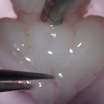 Video: Isolation of Cortical Microglia with Preserved Immunophenotype and Functionality From Murine Neonates