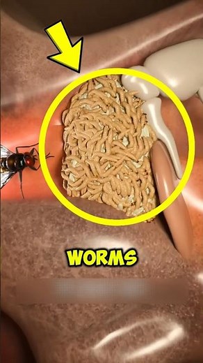 If You Ever Find Worms in Your Ear, DO THIS IMMEDIATELY!😱