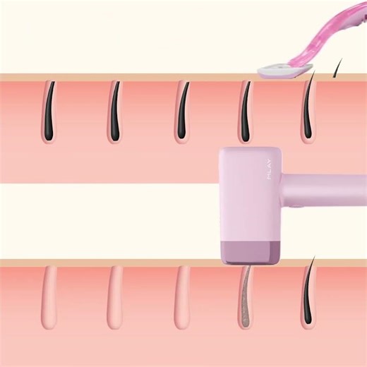 MLAY T14 vs Lâmina: Quem Leva a Melhor? #mlaybrasil #skincarebrasil #belezaemcasa #tecnologia #laser