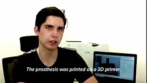 25K views · 5.4K reactions | A young, one-legged stork is learning to walk on its new 3D-printed prosthesis at a Czech animal rescue center | Reuters | Facebook