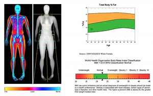Full body DEXA scan shows how much fat, muscle and bone one has