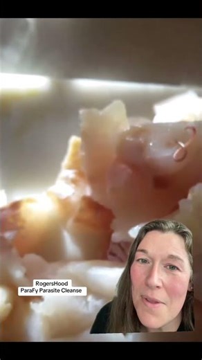 Fish have worms #cod #halibut #salmon #intestinalparasites #worms