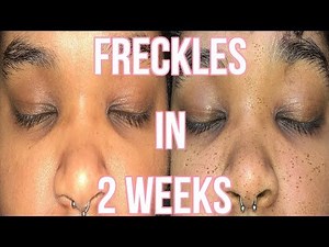 HOW I GOT REAL FRECKLES IN 2 WEEKS
