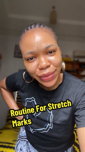 Replying to @pretty 😍😍😍 This is a simple routine that can tackle stretch marks, uneven skin tone, and body hyperpigmentation. Just add exfoliating to it and you’re good to go.