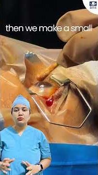Intravitreal Injection Procedure