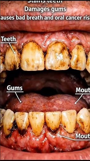 What Happens to Your Body When You Smoke | Health Effects Explained