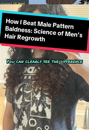 Men’s Hair Regrowth Science: How I beat Male Pattern Baldness. Definitely go check out @LifeAsZeph, he gives plenty of knowledge and insight and his recovery is nothing short of remarkable #creatorsearchinsights #malepatternbaldness #hairregrowth #dht #cutevtuber