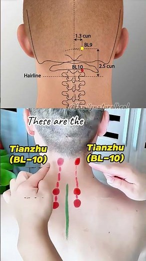 Targeted Acupoint Massage Reduces Desk Neck Strain