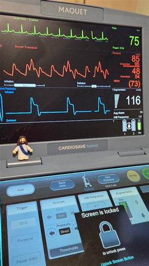 Sarah Vance | Critical Care Education for ICU Nurses on Instagram: "IABP 101: What counterpulsation is, and how it helps our patients! Intra-aortic balloon pump, aka counterpulsation therapy, is one of the many devices ICU nurses will manage. As you can see, there is a small balloon that will be percutaneously inserted into the femoral artery and advanced until the tip is distal to the left subclavian. The balloon inflates/deflates at programmed frequency. Balloon inflation: 🫀 Onset of diastole