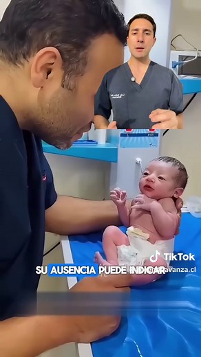 Reflejo de Moro en Neonatos: Valoración Neurológica Esencial