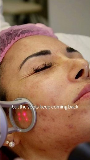 Pigmentation Treatment Explained by Doctor | Why Diagnosis Matters