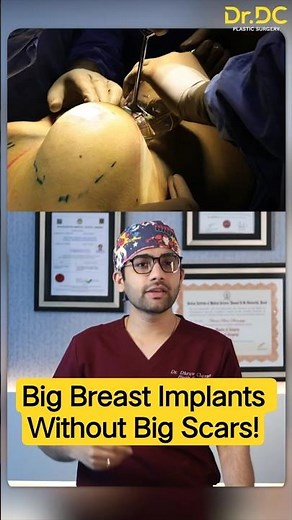 The Secret to Perfect Breast Implants: No More Large Scars!| Dr DC, Plastic Surgeon | India Pune