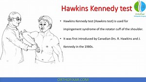 Hawkins Kennedy Test