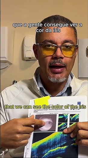 A tomografia de coerência óptica (OCT) mostrou um ÂNGULO FECHADO: O que fazer?