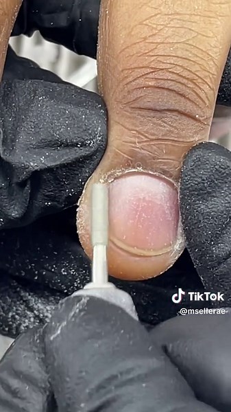 Effective Cuticle Removal Techniques for Beautiful Nails