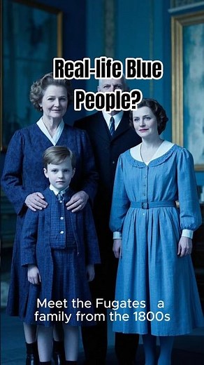 Real-life Blue People?! 😱