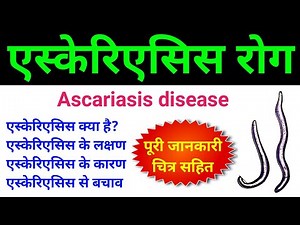 एस्केरिएसिस क्या है | ascariasis class 12 | ascariasis microbiology | ascariasis disease in hindi