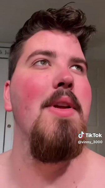 I wil never be the king…👑🔥 #tiktok #vinnyseries #fyp #comedy | vinny