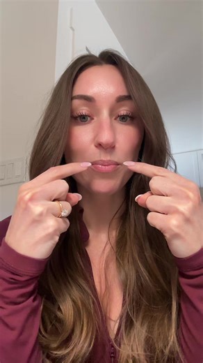 Treating a gummy smile with botox (brand of toxin does not matter) #gummysmilecorrection #gummysmile #botoxnatural #botox #lipinjector