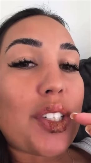 CTBullyBrown (Daym Drops) on Instagram: "😳😳 The CRAZY part is that there will STILL be a 🥷 in the comments talm’bout, “What’s her @ tho?” 👀👀 #QuenchYoThirst However, let me use this post as a teachable moment in NIGGOCITIES! 💥 Cold sores are typically from Herpes Simplex Virus type 1 (HSV-1). Spread Easily: HSV-1 spreads through skin-to-skin contact, most commonly sharing saliva via kissing, utensils, or drinks, often in childhood. 💥 If HSV-1 from a cold sore is transferred to the genital