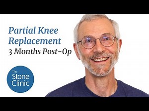 Partial Knee Replacement Surgery Patient Story (3-month post-op)