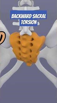 What's Hiding Behind Your BACK PAIN? Backward Sacral Torsion explained