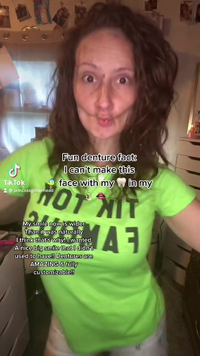 740K views · 3.2K reactions | For the new kids 殺 Get to know #princessglitterhead the #toothlessprincess #withorwithout #snapindentures #beforeandafter #dentureface ALL INFO YOU want to know is in the link below https://m.facebook.com/story.php?story_fbid=10219218646357163&id=1238687484&fs=e&s=cl | Alicia Hebner | Facebook