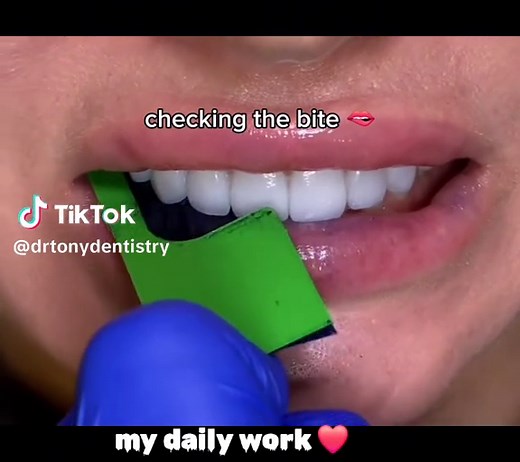 checking the bite 🫦 ❤️#drtonydentist #dental #toot #asmr #pyf #dentistasmr