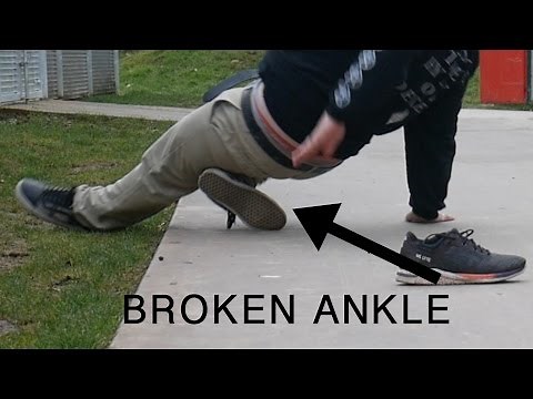 WATCH ME BREAK MY ANKLE.