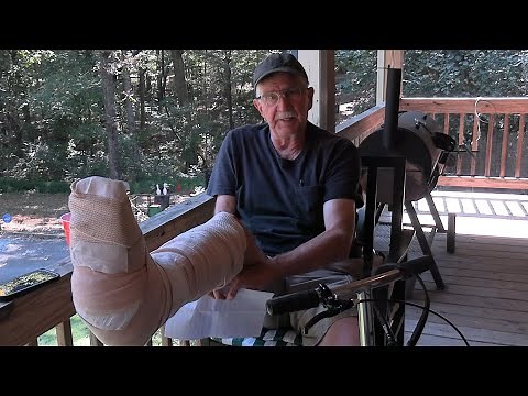 I Had A Motorcycle Accident