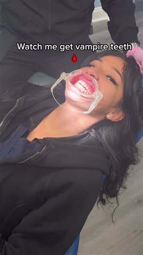 Vampire teeth for Halloween🩸 #vampireteeth #dentist #halloween #fyp | Natural Vampire Teeth