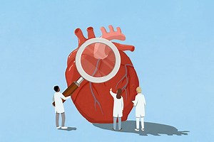 Heart Failure for Professionals