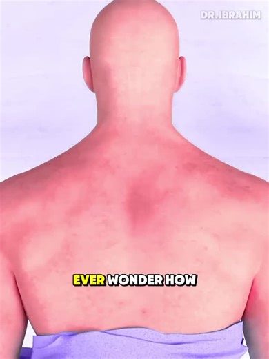 Understanding Craniectomy Brain Surgery: A 3D Medical Animation