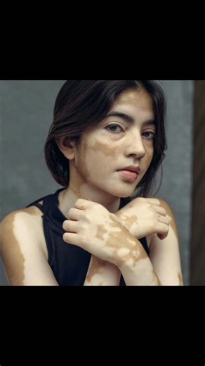 Rare body Features. Part -4