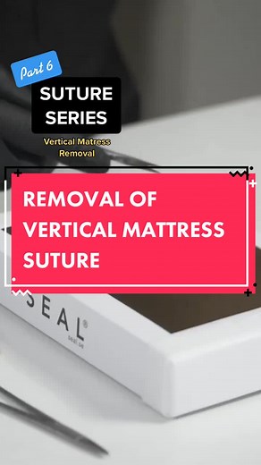 Vertical Mattress Removal #learnontiktok #sutureseries #plasticsurgery #sewing