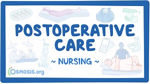 Postoperative care: Nursing: Video & Causes | Osmosis
