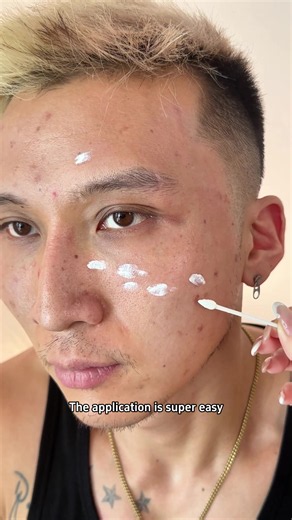 Dr Loria Drying Lotion: Spot Treatment for Acne That Works Daily