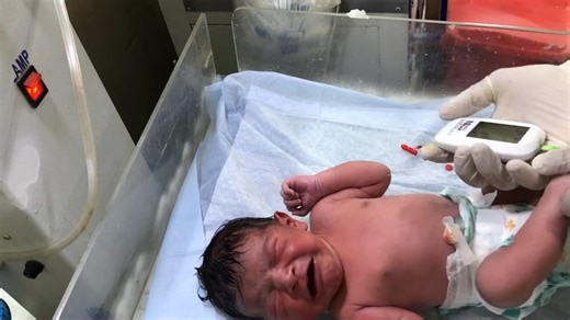 C-Section Baby Received in Emergency | Immediate Newborn Care & Investigation #newborncare #NICUCare #baby #urinaryretention the labor room and start emergency newborn assessment and investigations. Watch how we check the baby’s vitals, breathing pattern, temperature, blood sugar, and overall condition to ensure safe and early management. This video is helpful for: 👶 New nurses 👩‍⚕️ Pediatric staff 🏥 NICU & labor room workers 📚 Medical students If you like this video, don’t forget to LIKE, C