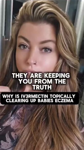 Eczema is not always a skin problem. In many cases, it’s a parasite problem. Yes, research and real-world cases show that eczema, dermatitis, and chronic skin rashes can be linked to parasites, mites, and toxic load inside the body. Here’s what most people are never told: 1. Microscopic parasites on the skin Demodex mites are microscopic parasites that live in hair follicles and oil glands. When they overgrow, they’ve been linked to eczema, rosacea, dermatitis, and chronic inflammation. This is 