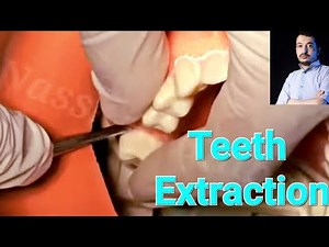 Demonstration Of teeth Extraction | oral surgery | #dentistry #dentalstudent #dentist #oralsurgery