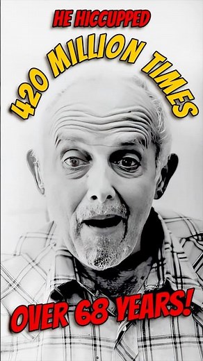 He Hiccupped 420 MILLION Times!