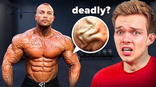 Why Do Bodybuilder Veins Look Like That?
