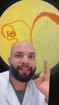 🪱 Trichuris trichiura: o verme do chicote!