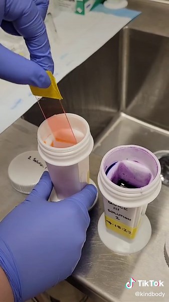 Importance of Morphology Assessment in Semen Analysis