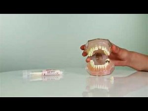 Refit Dental Cap - How to temporarily re-cement dislodged dental cap