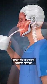 👨‍⚕️ Dr. Manoj Lahoti explains Achalasia Cardia and how modern diagnostic tests help this condition.