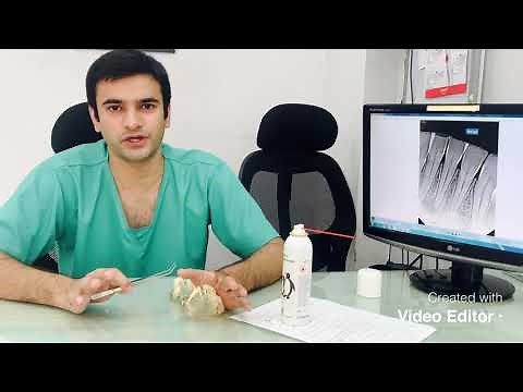 Pulp Vitality Test - Case Discussion