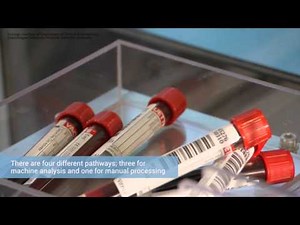 Universal Robots ensure faster blood sample results